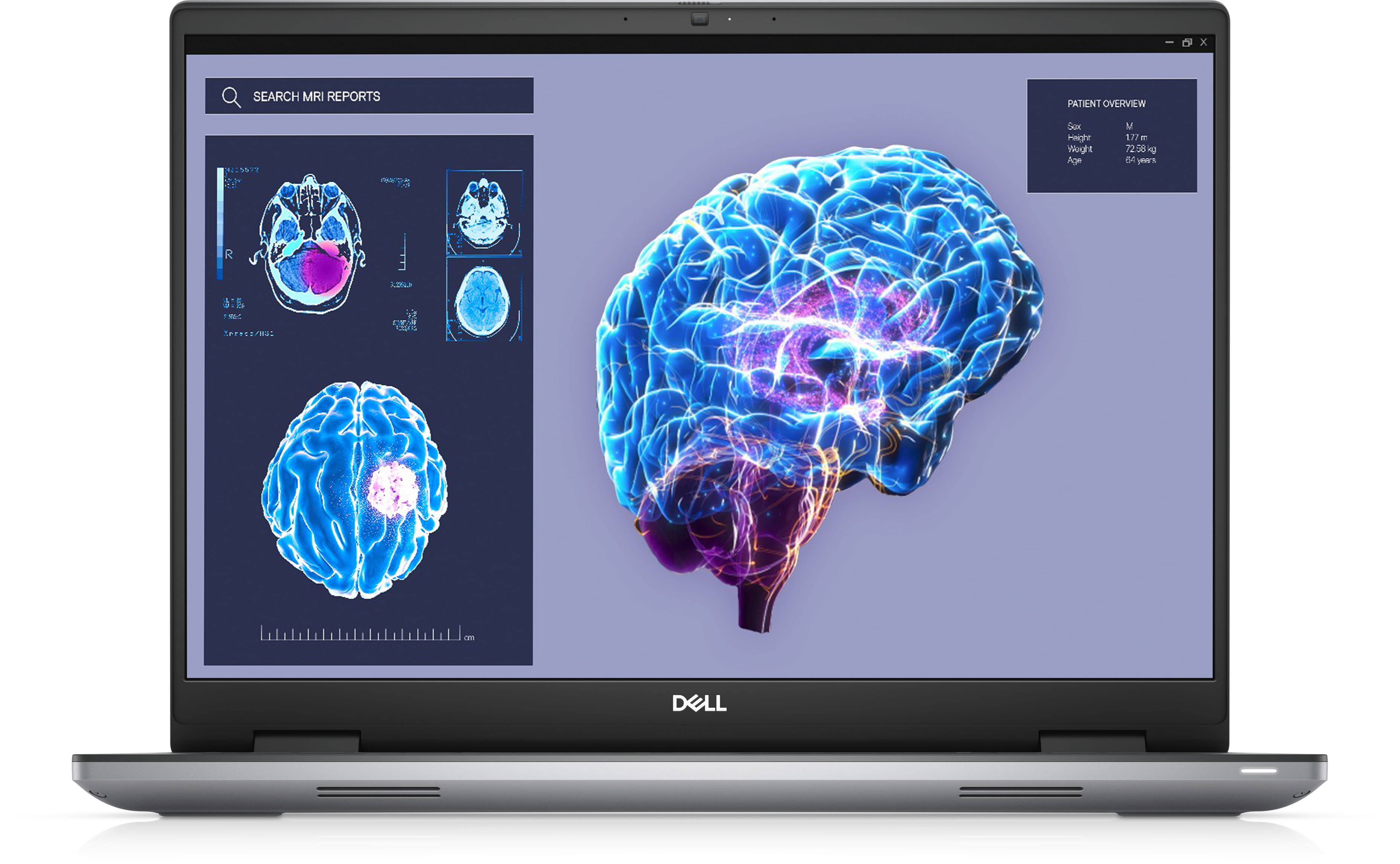 Dell Precision 7680 - Intel Core i7 13850HX / 2.2 GHz - Win 11 Pro - NVIDIA RTX 2000 Ada - 32 GB RAM - 1 TB SSD NVMe, Class 40 - 40.64 cm (16")
